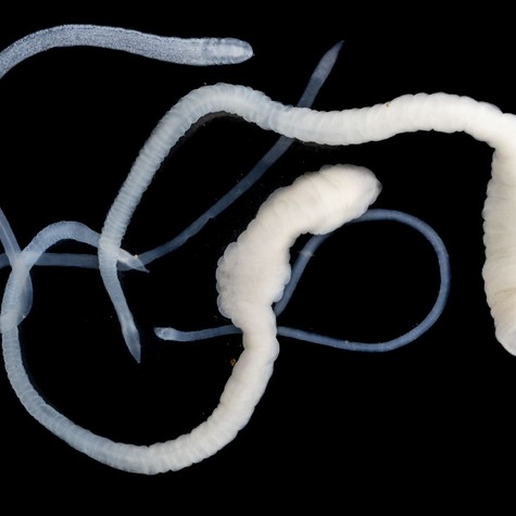 Ezek a tünetek jelezhetik azt, hogy galandféreg él a szervezetében című cikk nyitóképe