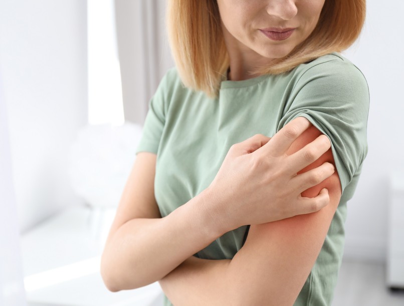 mi a viszkető bőrkiütés