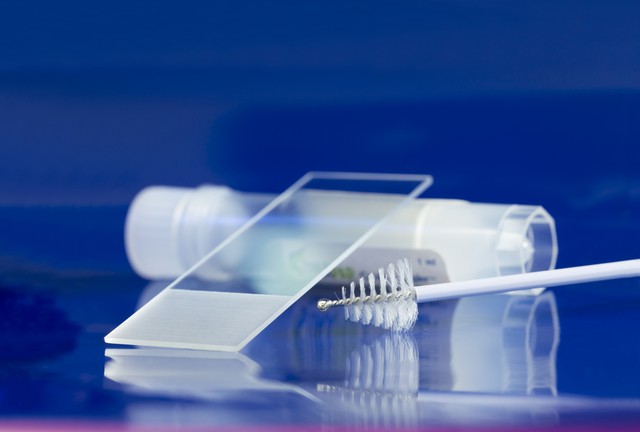 Két módszer, amit bármikor bevethet a méhnyakrák ellen