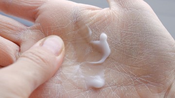 Ha ilyen vízhiányos, száraz a bőre, kevésbé képes ellenállni a kórokozóknak