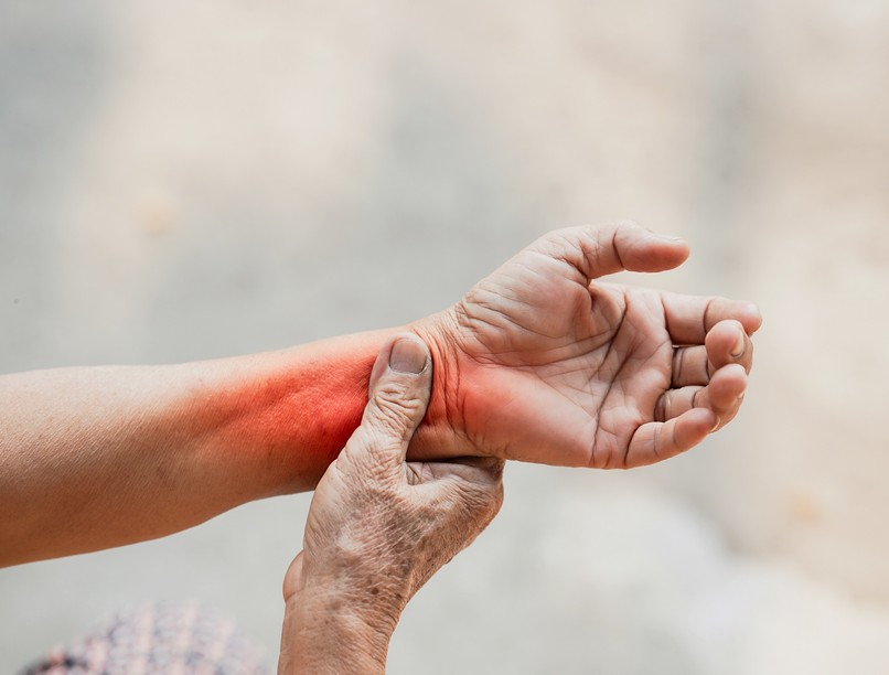 rheumatoid artritisz is okozhat reggeli ízületi merevséget