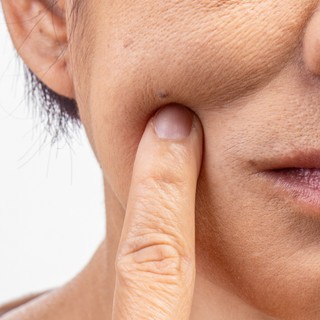 Túl gyors öregedés: a rák sajátos mellékhatása, vagy akár tünete is lehet című cikk nyitóképe