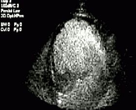 Tudományos siker: testben utazó mikrobuborékok