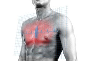 Szegény szomszédok - és halálos veszélyek?
