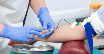  Mi a vérátömlesztés? 