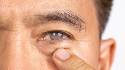 Szürkehályog műtét után: a gyógyulás hetei, amiről kevesen beszélnek című cikk nyitóképe