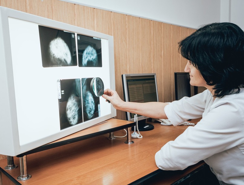 mammográfia, szoptatás, kismama, az orvos válaszol