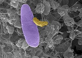 A Micavibrio aeruginosavorus (sárga) egy Pseudomonas aeruginosa baktériumot zsákmányol (lila). Fotó: Daniel Kadouri, New Jersey Orvosi és Fogászati ​​Egyeteme