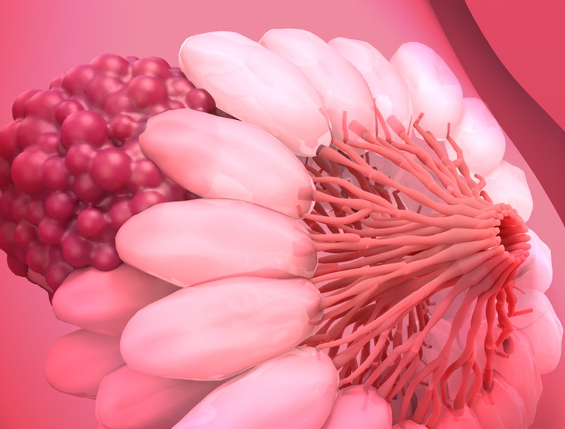 mellrák, emlőrák, tripla negatív emlőrák, gyógyszer, kutatás, ERX-41