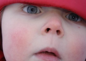 Mitől nem szelel a gyerekünk orra?