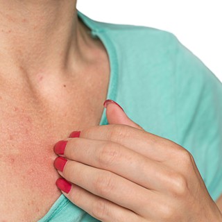 Viszkető kiütések nyáron? Ezektől a gyógyszerektől is lehet! című cikk nyitóképe