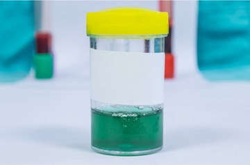 Kék vagy zöld színű vizelet: nem mindig kóros, de legyen gyanús, ha ilyen