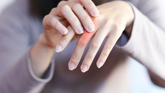 Zsibbad, sajog, gyenge a keze? A kézfájdalom leggyakoribb okai