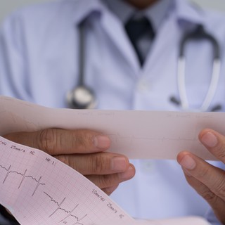 Pitvarfibrilláció: ezek a tünetek akár évekkel korábban előre jelezhetik című cikk nyitóképe