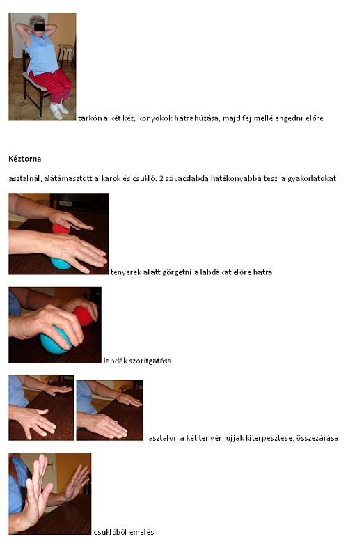 Parkinson-kór gyógytorna kezelése (3. rész)