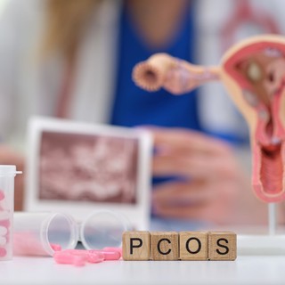 Hogyan gyógyítható a PCOS? Ez az, amit jó tudni a diagnózis után című cikk nyitóképe