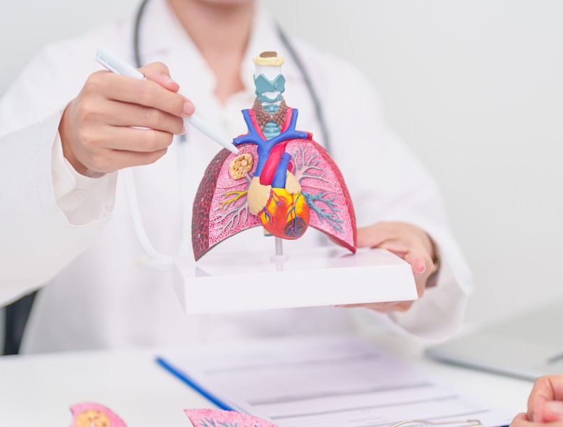 Emfizéma tüdőtágulat