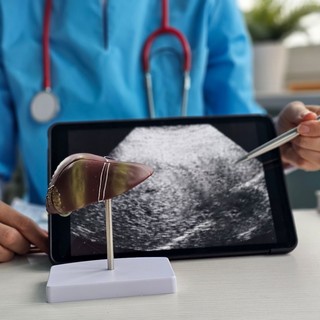 Hogyan gyógyítható a májrák? A modern onkológia valódi lehetőségei és korlátai  című cikk nyitóképe