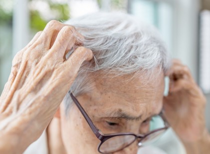 Sárgás, hámló lerakódás a fejbőrön - ez állhat a háttérben című cikk nyitóképe