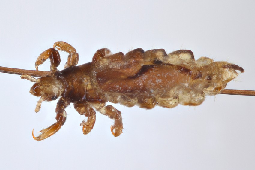 A fejtetű 2,5 - 4,5 mm nagyságú, ovális alakú rovar. A színe általában szürke, de ez a haj színétől függően változhat. Petéit (serkéit) a hajas fejbőrön, a hajszálak tövében helyezi el, leggyakrabban a halánték- és tarkótájon.