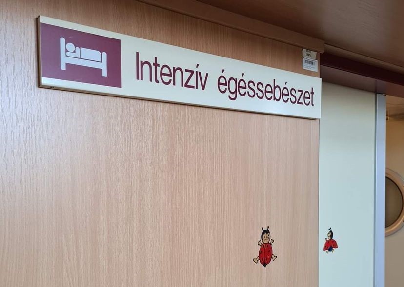 Az biztos, hogy a felnőttek nagy része sem tudja, hogy súlyos égési sérüléseket lehet szerezni ettől.