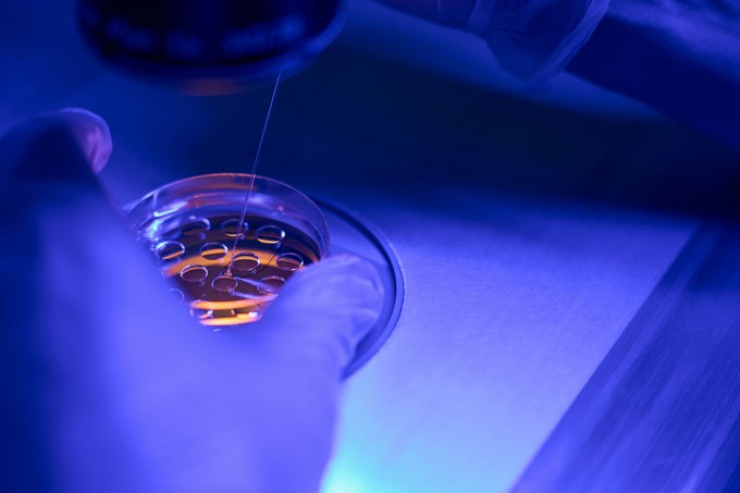 Mire jó a biopszia? Ha egy ilyen vizsgálat után visszahívják, még nem feltétlen jelent rákot című cikk nyitóképe