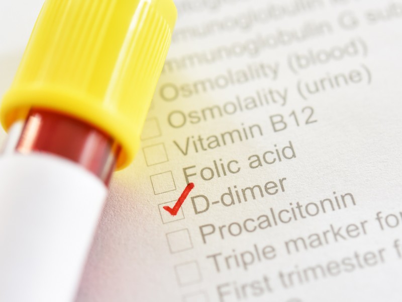 Mit jelent a magas D-dimer érték? Erre utal a laboreredmény