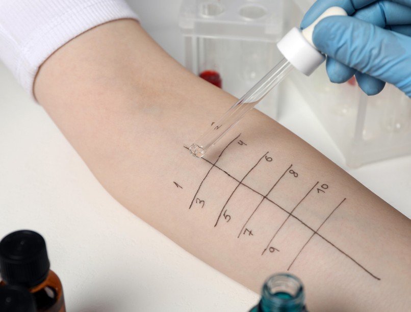 Allergiavizsgálat előtt orvos tanács