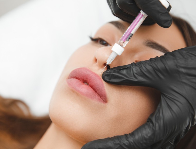 szájtöltés, hialuronsav, szövetelhalás