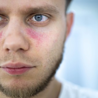 Ha ilyen az arca, nagyobb az esélye a trombózisra című cikk nyitóképe