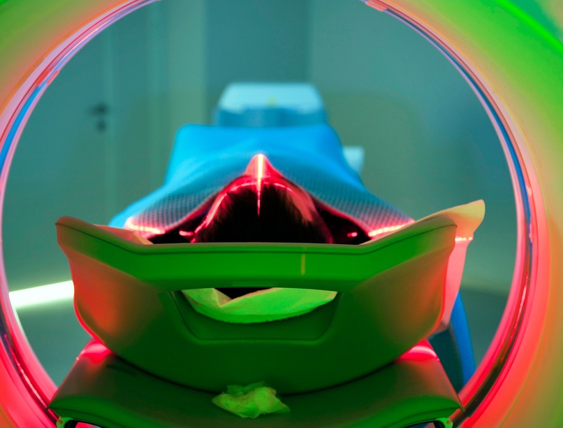 sugárkezelés radioterápia kezelés leírás