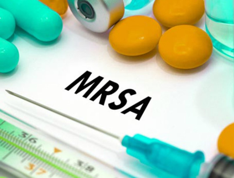 mrsa_nyito