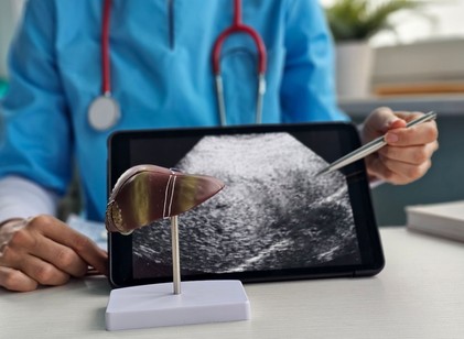 Hogyan gyógyítható a májrák? A modern onkológia valódi lehetőségei és korlátai  című cikk nyitóképe