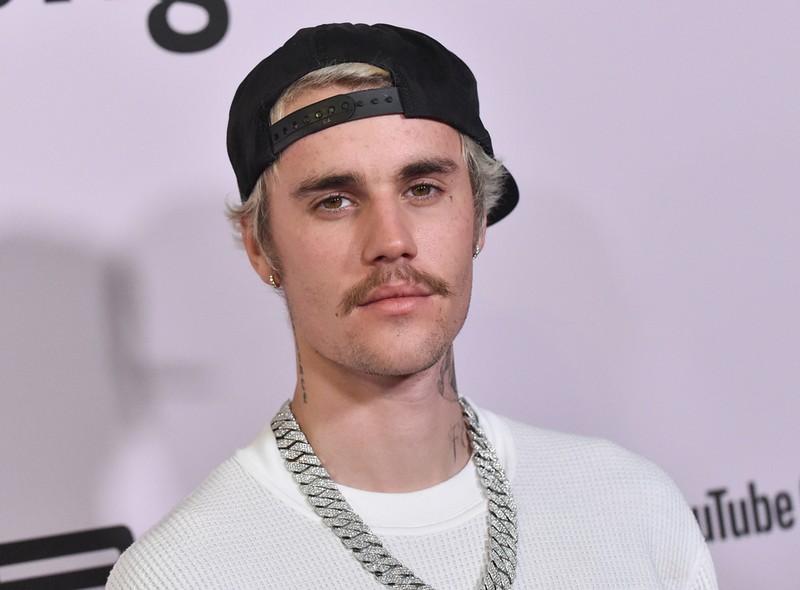 Egy vírus miatt lebénult Justin Bieber fél arca