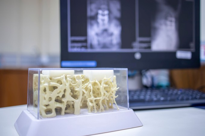 Ezért gyengülnek el a csontjaink! Nem kell beletörődni: így erősítheti meg akár 50 felett is című cikk nyitóképe