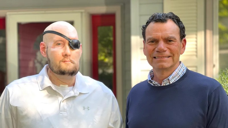 Óriási siker: megtörtént a világ első szemgolyó- és részleges arcátültetése