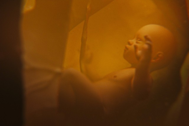 Drámaian megnőtt hazánkban a veleszületett szifilisz előfordulása