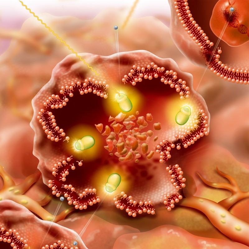 Tudta? Ez az 5 dolog növelheti a hasnyálmirigyrák kockázatát!