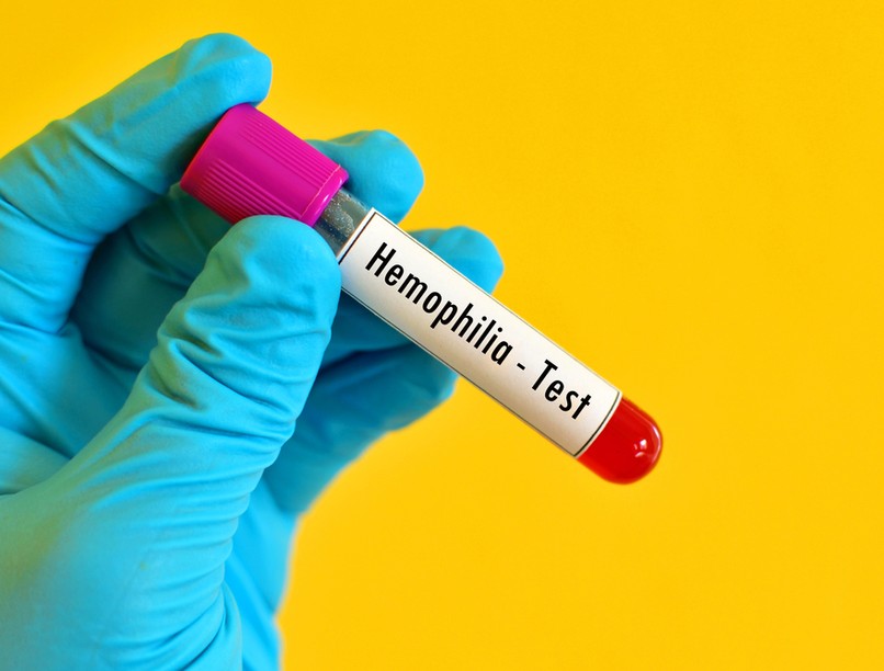 hemofília, vérzékenység, világnap