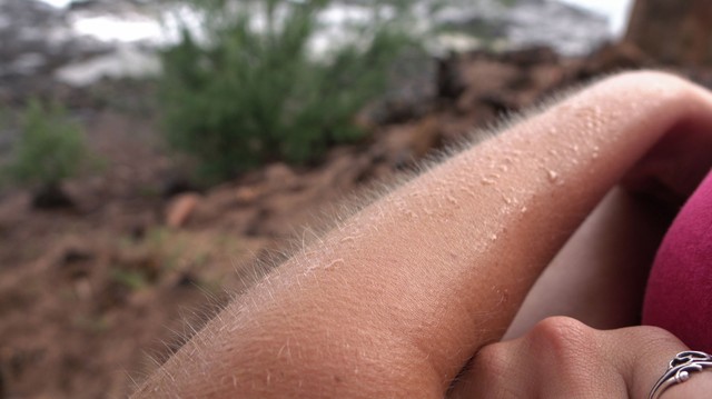 Ez az oka annak, hogy libabőrösök leszünk bizonyos helyzetekben