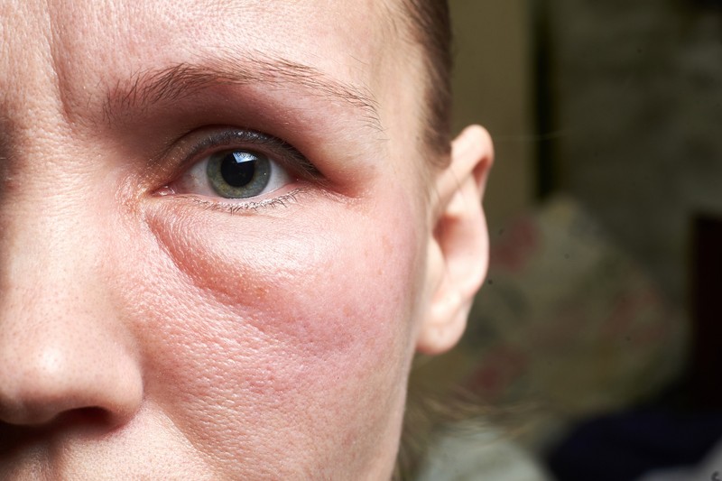 Ezt a 4 szokatlan, furcsa tünetet pajzsmirigyprobléma is okozhatja