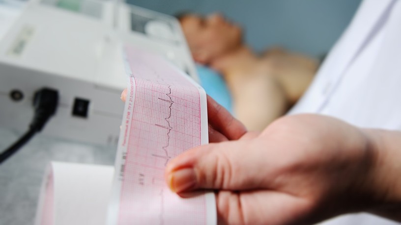 ekg_2