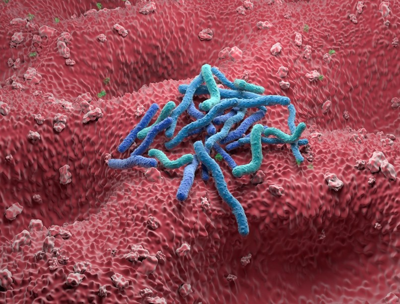 intuíció gyomorfekély oka helicobacter pylori