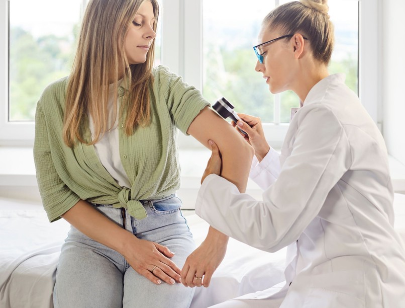 orvos válaszol anyajegyszűrés drága dermatoszkóp