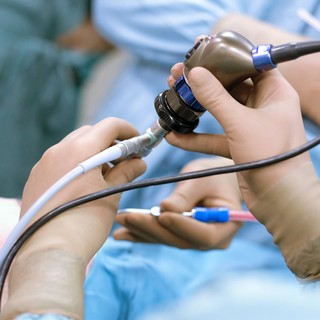 Mitől függ, hogy mennyire fáj a gyomortükrözés? című cikk nyitóképe