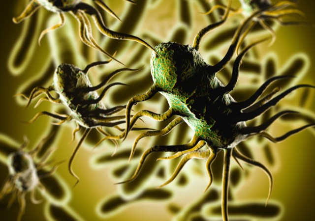 Liszteriózis fertőzés oka, tünete, lefolyása és kezelése