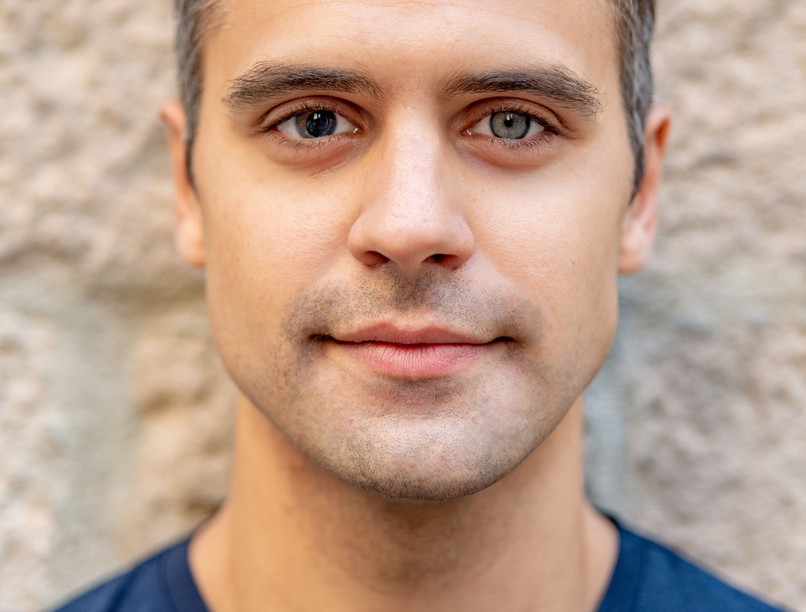 szembetegségek különböző színű szem heterokrómia oka