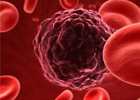 Könnyebb a megelőzés - mint a gyógyítás (nemcsak daganatok esetén)