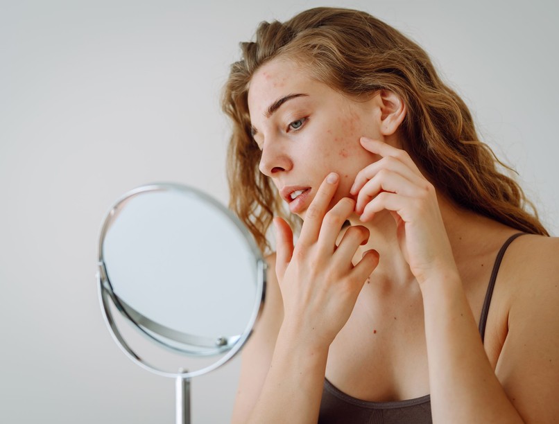 halál háromszöge arc pattanás