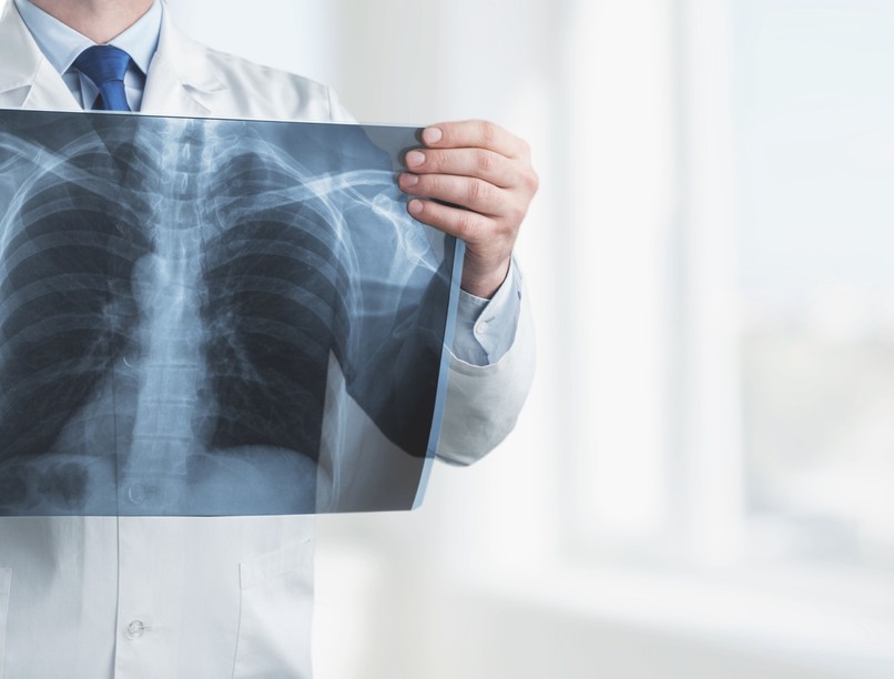 COPD, tüdő, dohányzás, nehézlégzés, légszomj